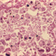 Illustration for article titled Solving the Mystery of Legionnaires Disease